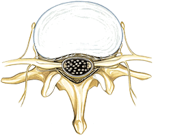 Normaler Spinalkanal